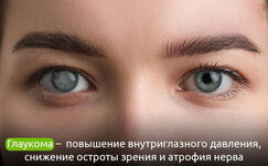chto-takoe-glaukoma__fzh9QUnO81bRd27B.jpg chto-takoe-glaukoma__fzh9QUnO81bRd27B.jpg